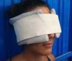 Aplicador de Frio Maxilofacial – Alívio Rápido para Dor e Inflamação