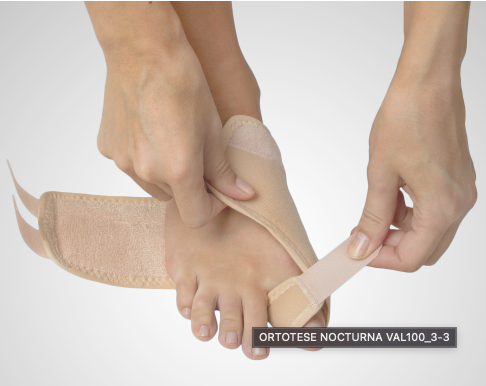 Ortótese Noturna para Joanete (Hallux Valgus) VAL100 – Pé Esquerdo
